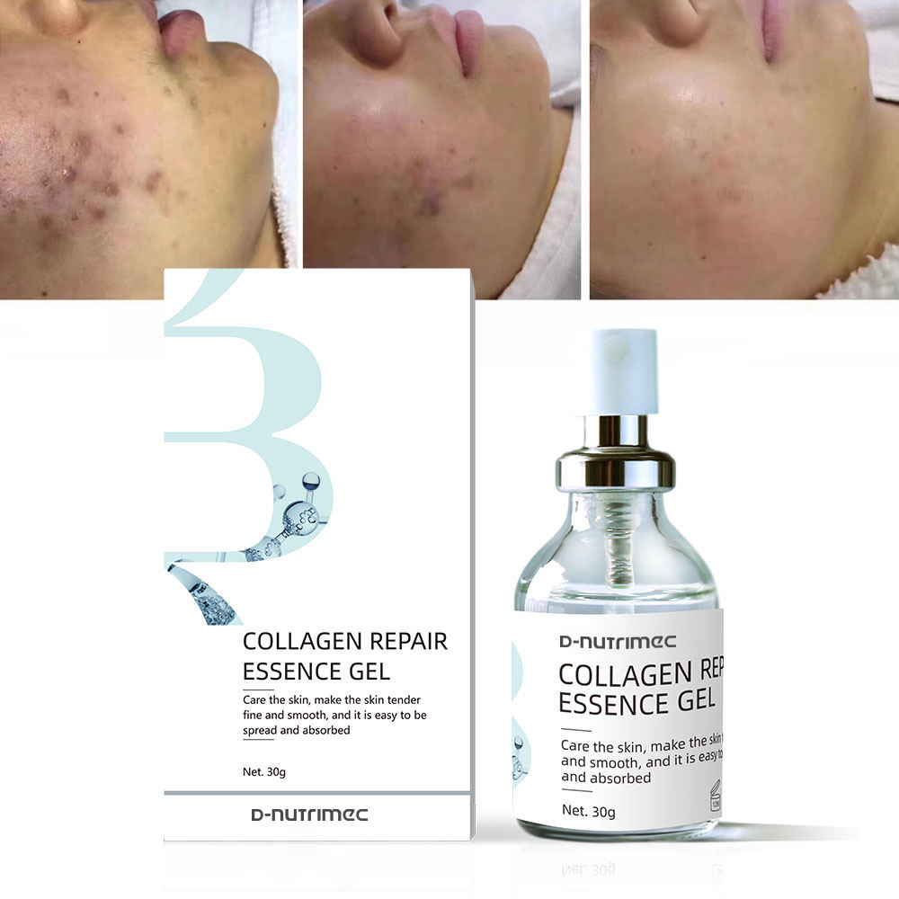 D-Nutrimec Recombinant Type III Humanized Collagen Repair Serum Gel Acne Treatment Whitening Moisturizer Anti-Aging Face Serum